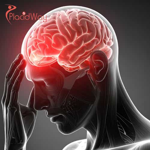 Neurology Stem Cell Treatment in Colombia: An Expert Guide for Medical Tourists